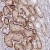 Immunohistochemistry-Paraffin: Abhd5 Antibody [NBP1-84507] - Immunohistochemical staining of human kidney shows strong cytoplasmic positivity in renal tubules.